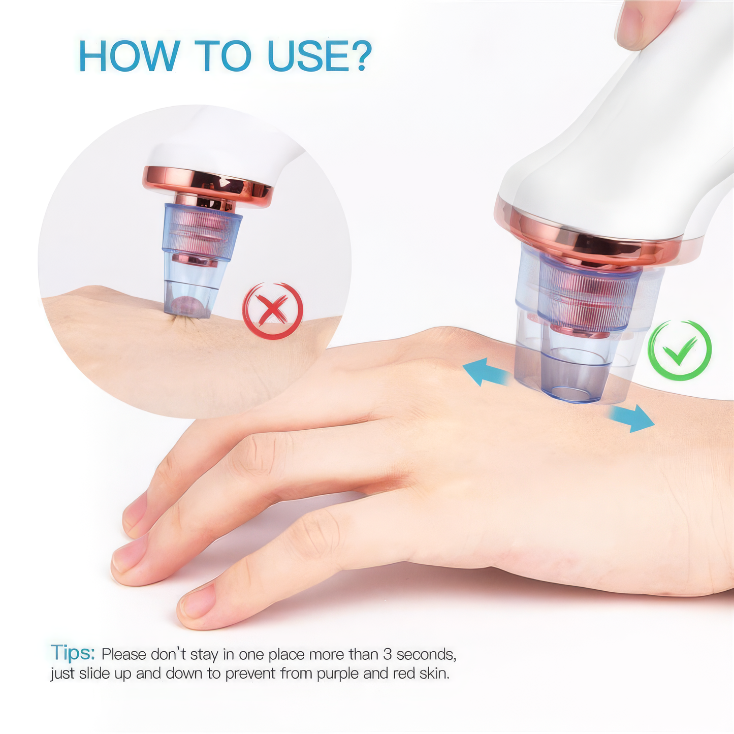 Blackhead Remover